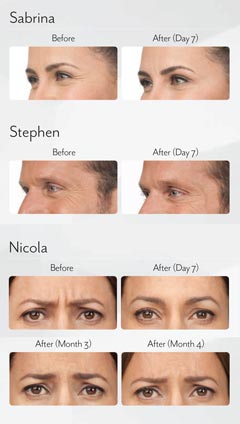 Patient_Before-After